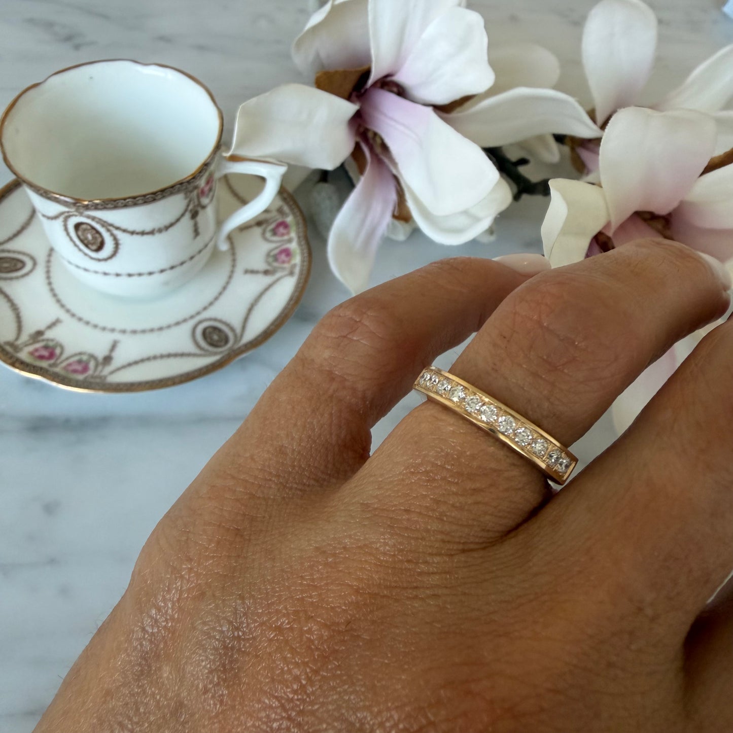 Anillo Eponea
